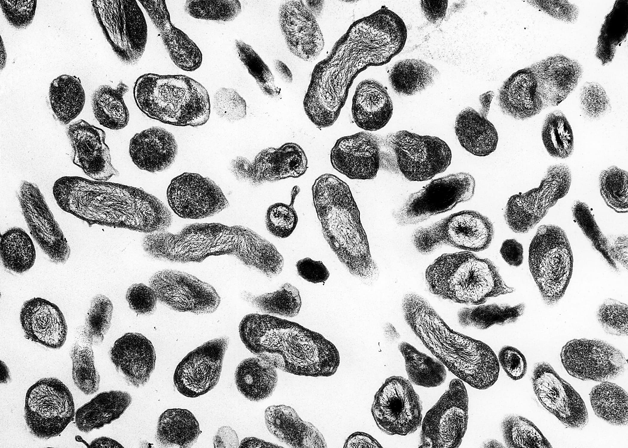 Muere una investigadora en un laboratorio de Siberia tras un posible accidente con un patógeno de la peste