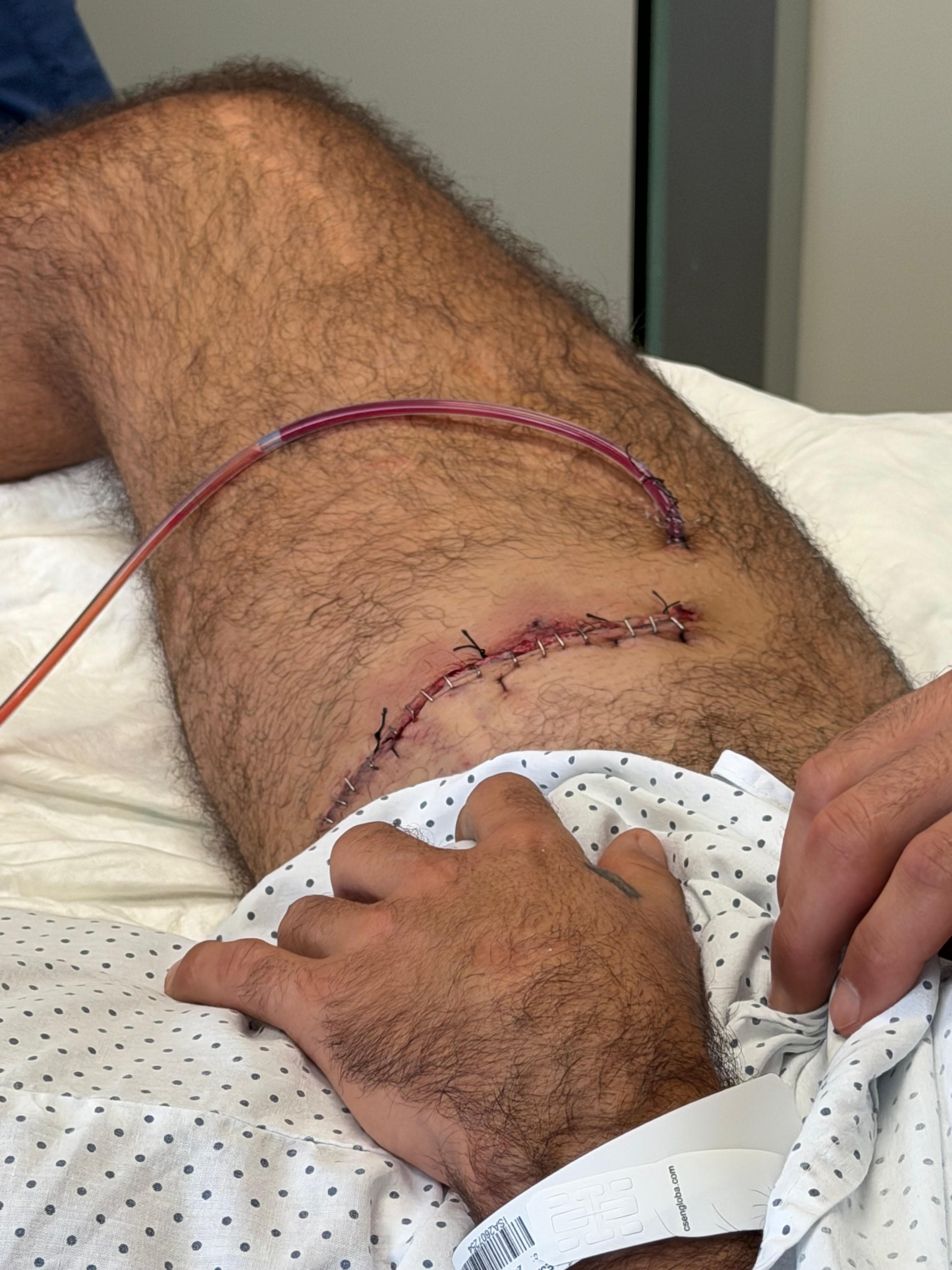 Alejandro Talavante, tras la cornada de Sevilla: "Me ha rajado la pierna como con una navaja"