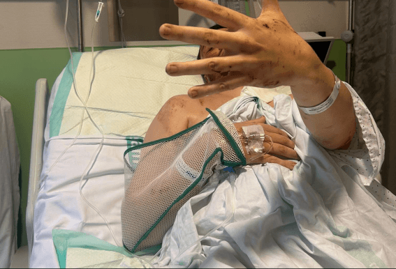 El testimonio de un italoargentino tras el choque de trenes en Toledo: "Mi hermana estaba a mi lado. La vi muerta, ya no tengo esperanza de encontrarla"